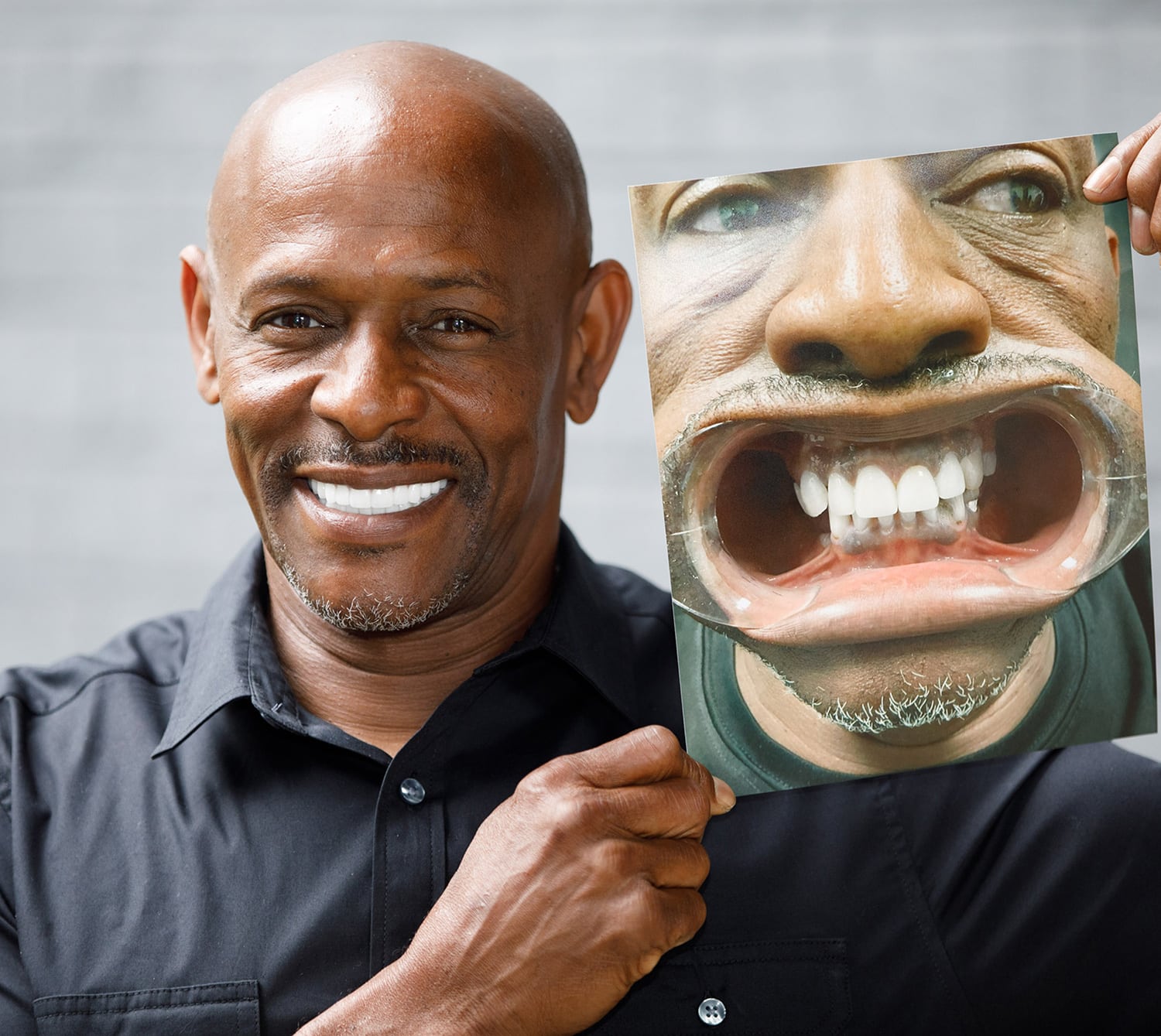 About_Us_Block_3 Man smiling after a dental implant clinic in Atlanta, GA
