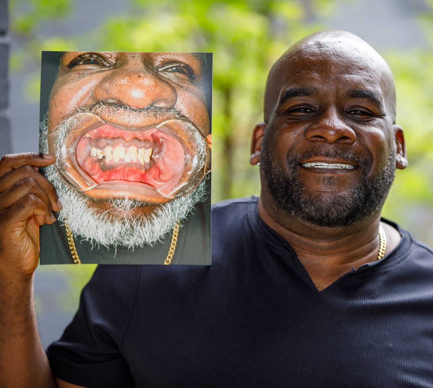 Services_Block_2 Tooth implant services in Atlanta, GA
