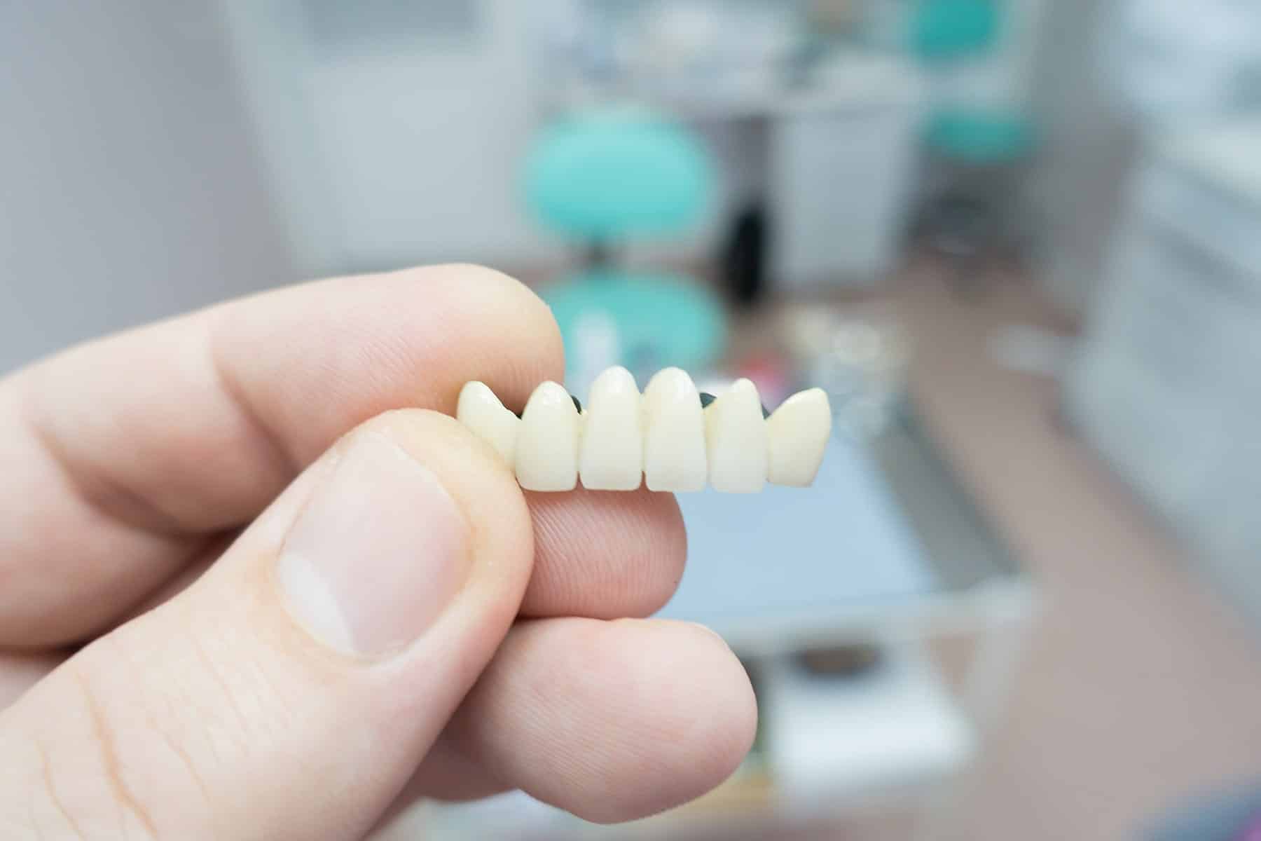 Implant bridge dentist in Sandy Springs, GA