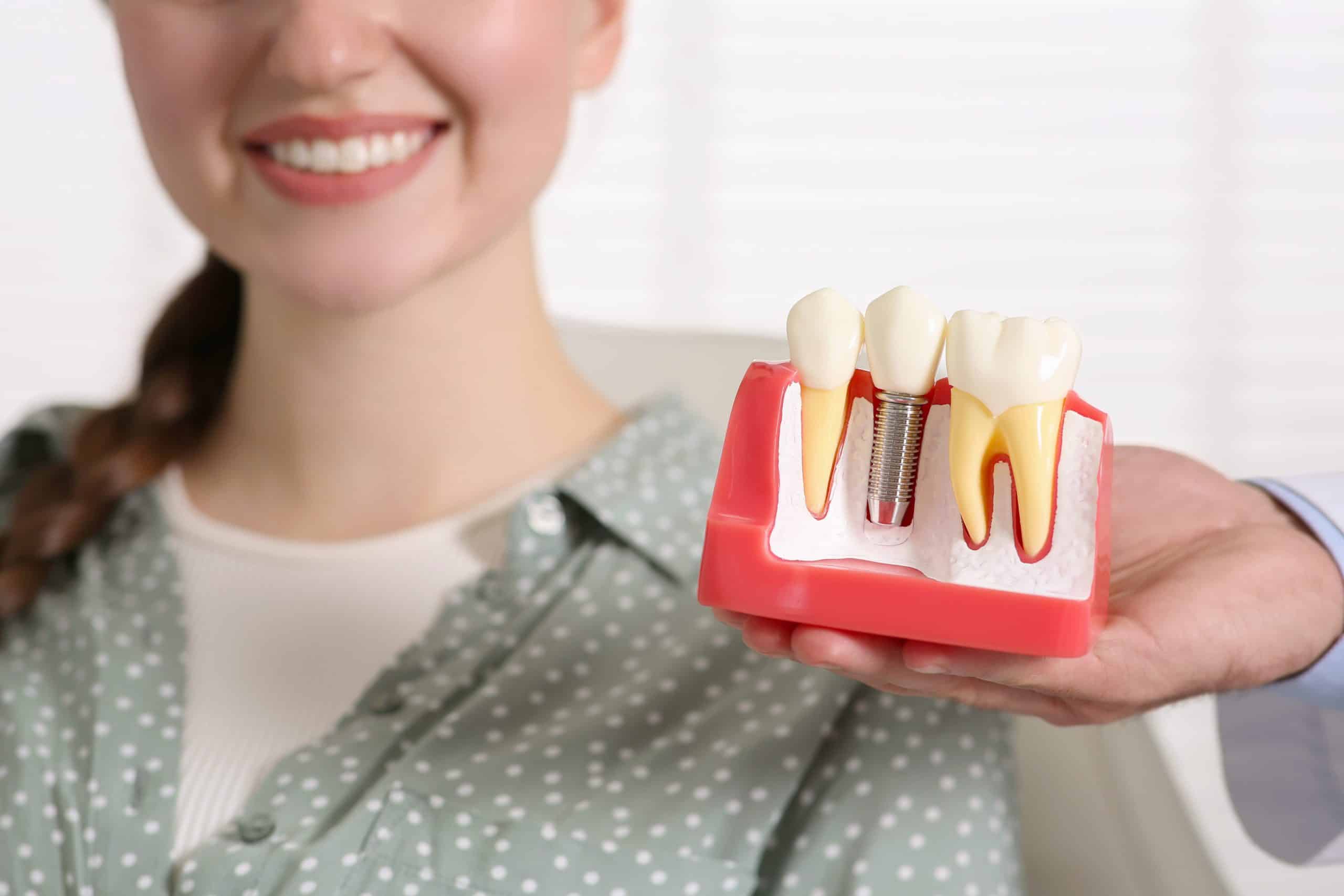 Tooth Implant replacement in Sandy Springs, GA